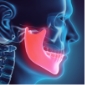 Animated jaw and skull bone used to guide jaw surgery