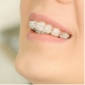 Closeup of smile with clear and ceramic braces