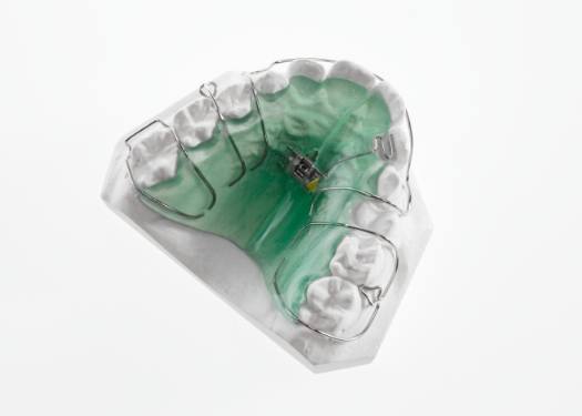 Orthodontic appliance on model of row of teeth