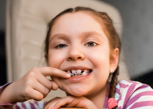 Child with orthodontics pointing to smile