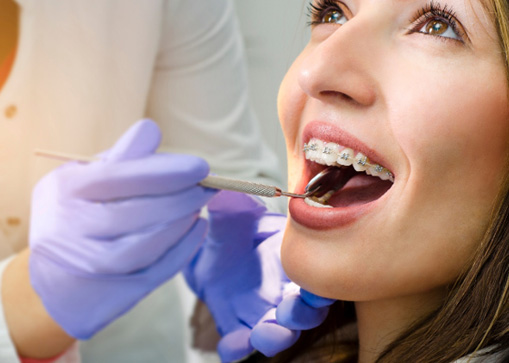 A woman at the orthodontist