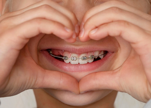 A child with braces